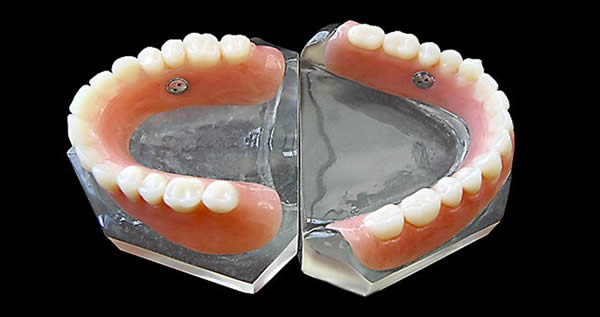 Upper Dentures Before And 
      After Pictures Fisher MN 56723